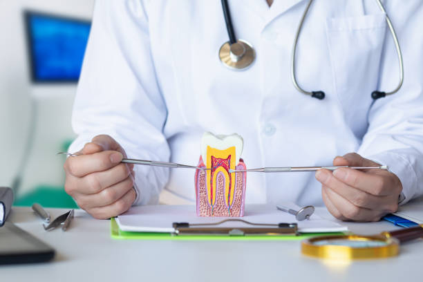 Best Knocked-Out Tooth (Avulsed Tooth) Treatment in Glendora, NJ